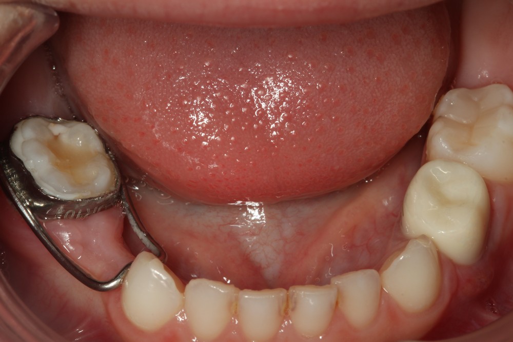 Bastante Etapa cuscús Odontopediatría en Elche - Clínica dental para niños