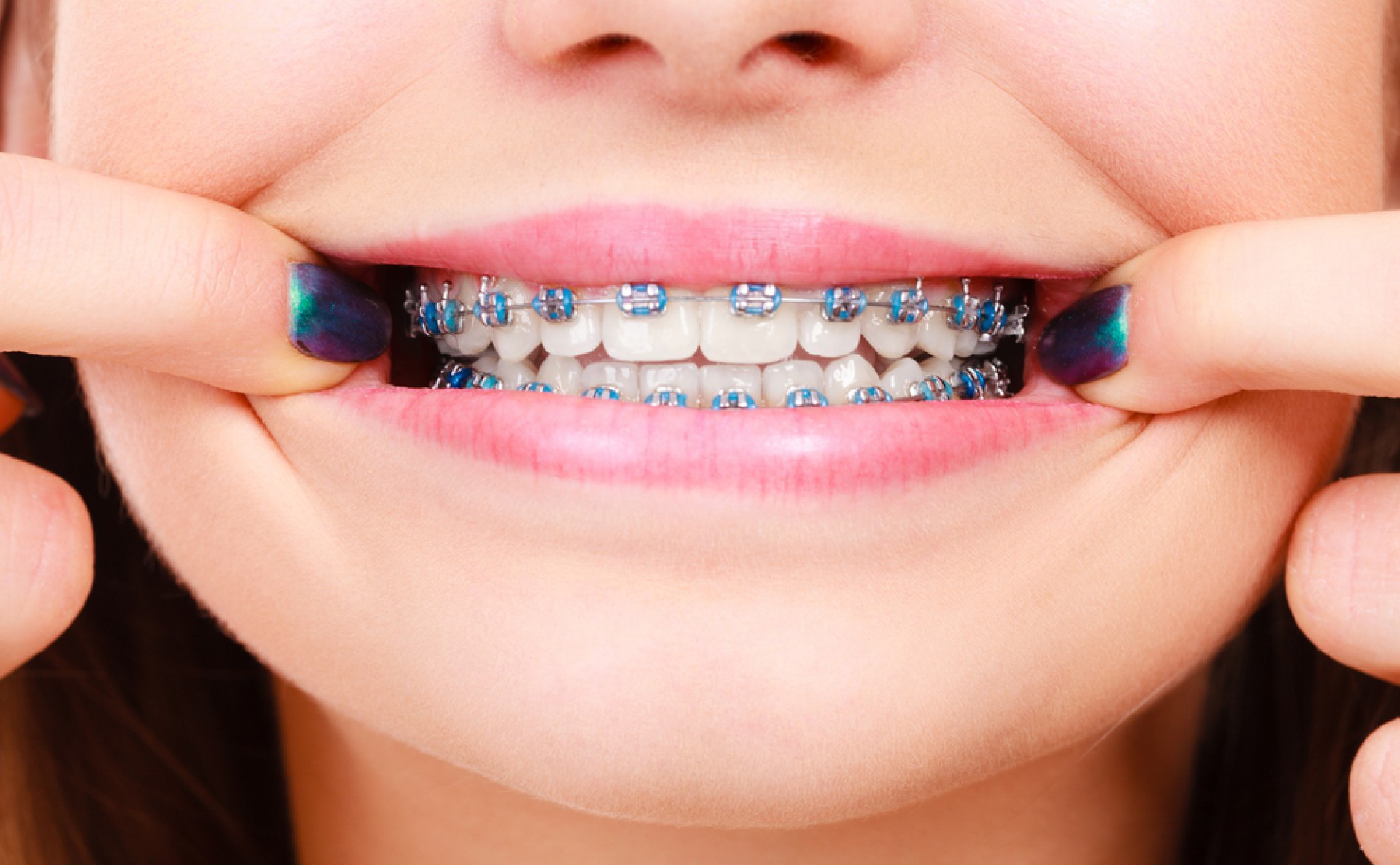 Una ortodoncia a tiempo, un salvavidas para tu sonrisa